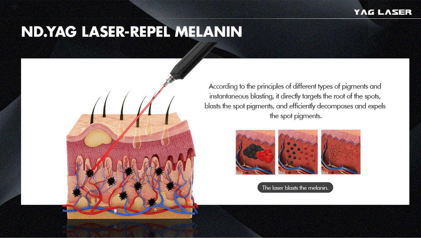 Carbon Peel Skin Whitening Q Switched Nd Yag Laser Tattoo Removal Pico Laser Machine