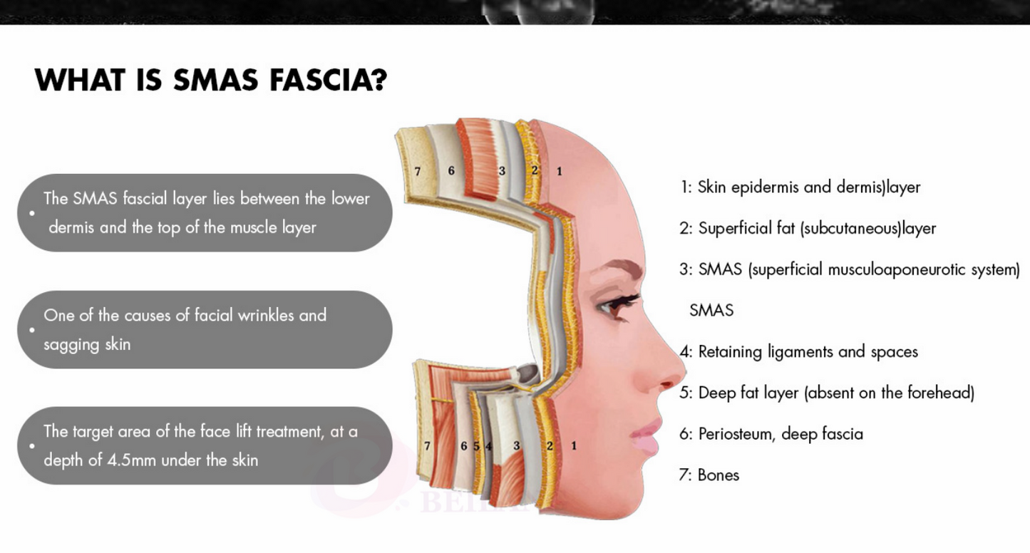 New Style 2 in 1 Focused RF & 3D Hifu Skin Lift Anti-aging Facial Lifting Anti Wrinkle Machine 12 lines